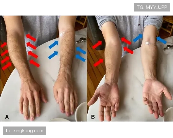 大腿肌肉拉伤至少需要一周恢复 萨林杰可能错过大部分常规赛 大腿肌肉拉伤至少需要一周恢复 萨林杰可能错过大部分常规赛